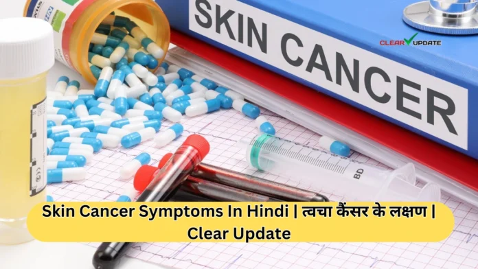 Skin Cancer Symptoms In Hindi